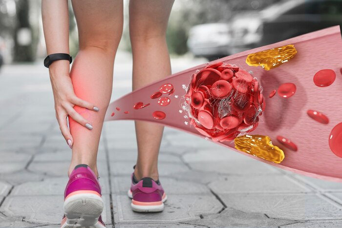 Comparativa Rápida de Suplementos para Varices
